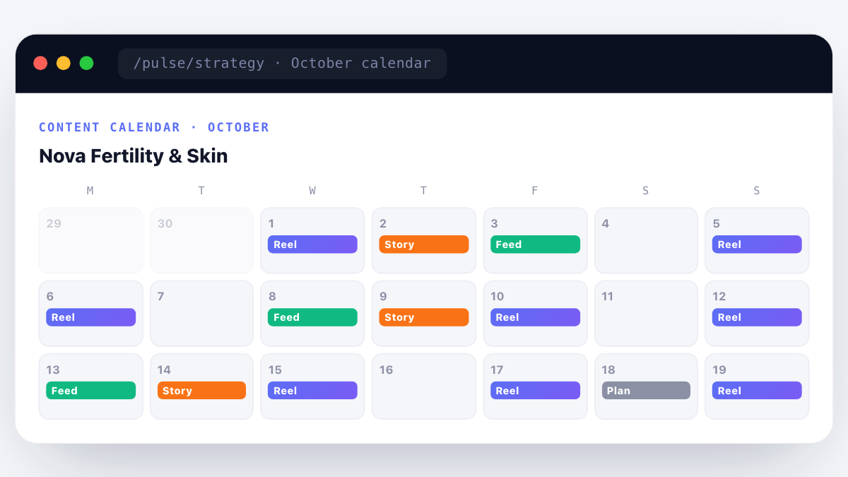 Prism Pulse content calendar showing the month ahead with Reel, Feed and Story slots colour-coded per day for a healthcare Instagram account